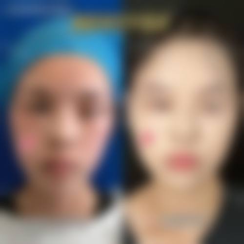 二、北京凤凰医院整形科正规吗?来看看医院资质: