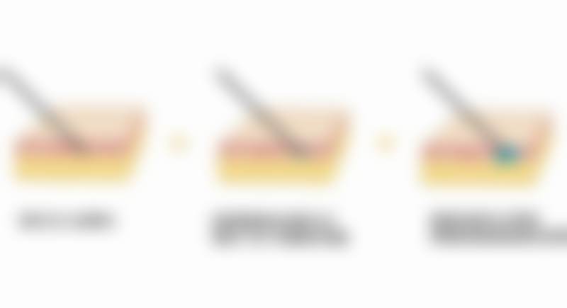 其他鼻部整形医生