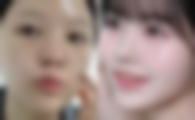 五、湘潭环美千颜医疗美容诊所怎么预约: