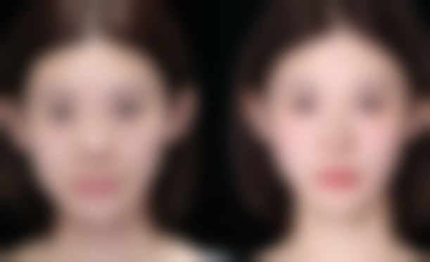 五、合肥壹美整形医院实例