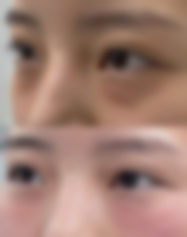 五、什邡雅筑伊美整形医院怎么预约: