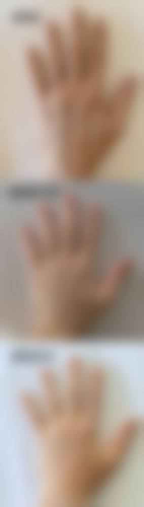 八、南昌针美荟整形医院真实的顾客评价如下：