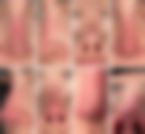 八、西安出彩医疗美容门诊部真实的顾客评价如下：