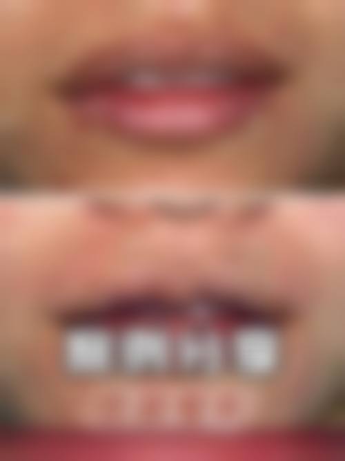 三、菏泽郓城友谊医院整形科基本信息: