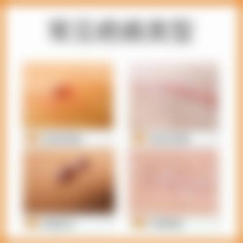 白升烈医生口碑和评价