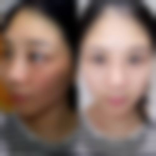 尹婷微医生在哪家医院怎么预约？