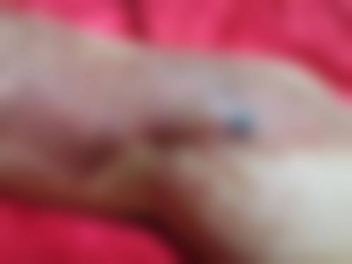 八、韩国首尔B&Young皮肤科整形外科真实的顾客评价如下: