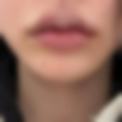 五、菏泽郓城友谊医院整形科怎么预约: