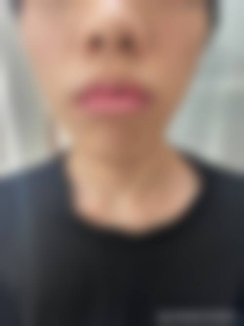 六、菏泽郓城友谊医院整形科价格表:(仅供参考)