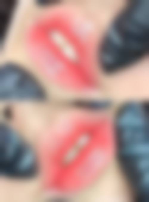 四、菏泽郓城友谊医院整形科实例