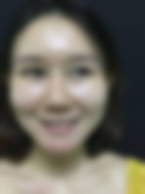 六、海口琼山亿佳医疗整形美容价格表：（仅供参考）