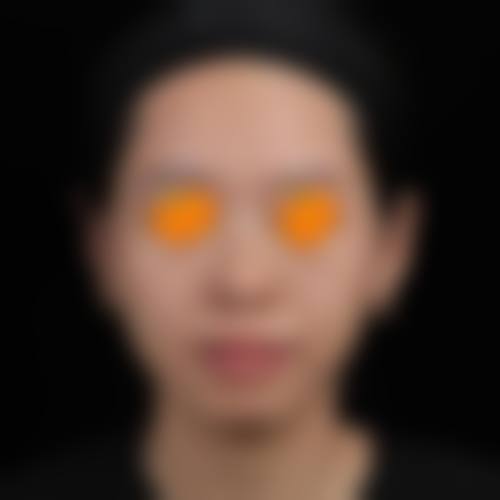 四、海口琼山亿佳医疗整形美容实例