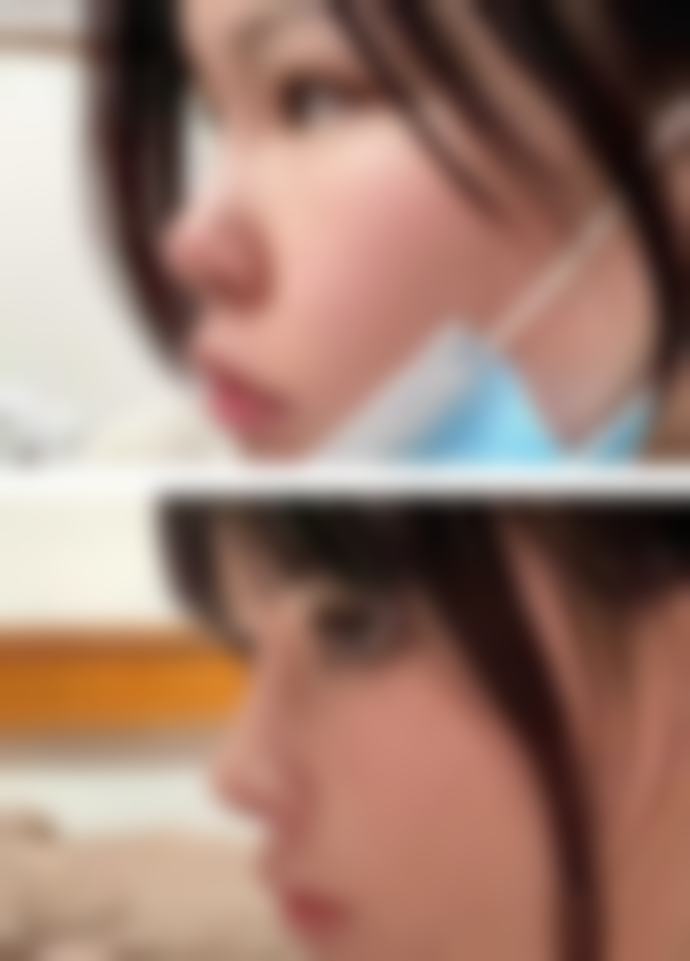 六、柳州医美整形美容怎么预约：