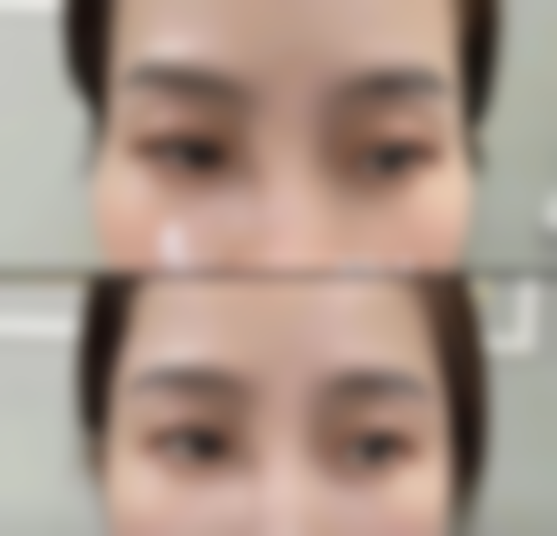 二、菏泽郓城友谊医院整形科正规吗?来看看医院资质: