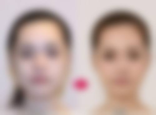 哪种方法去除眼袋好？非手术祛眼袋方法来帮忙