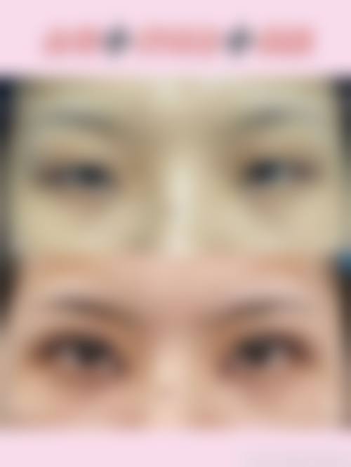 六、佛山禅城叶玉红整形医院怎么预约: