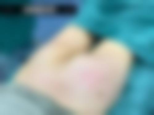 七、商丘冰薇医疗美容诊所价格表：（仅供参考）