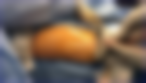 六、广州雅丽达医学美容怎么预约：