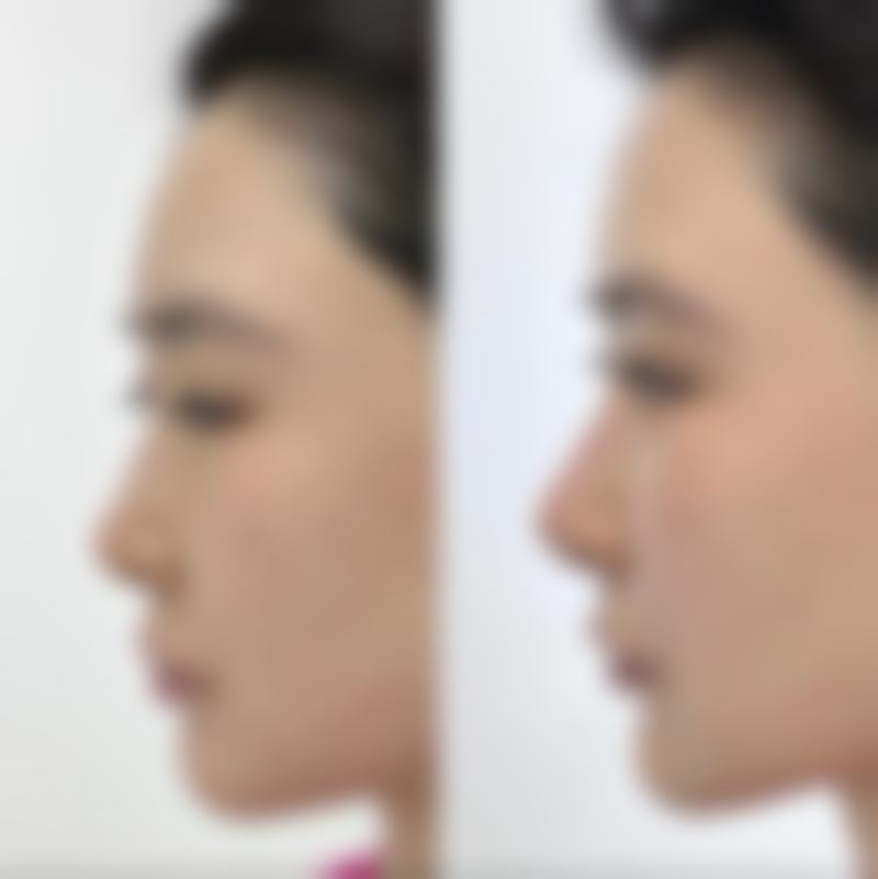 七、西安诺颜整形医疗美容医院价格表:(仅供参考)