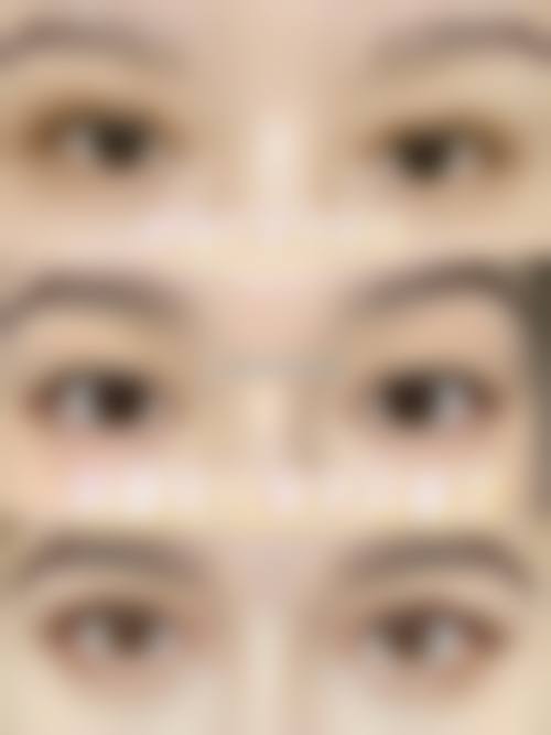 五、鞍山市第三医院整形美容外科实例