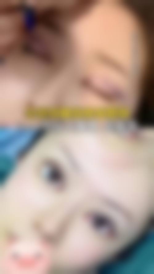 五、兰州嘉琳医学美容医院实例