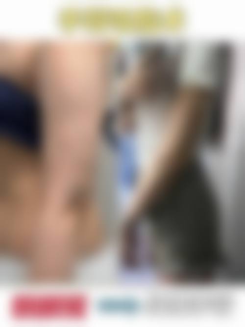 八、鞍山市第三医院整形美容外科真实的顾客评价如下：