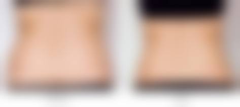 六、徐州伊博士韩式整形基地价格表：（仅供参考）