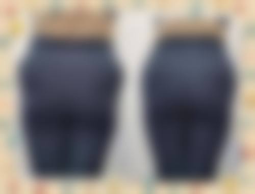 五、沈阳李淼医疗整形美容实例