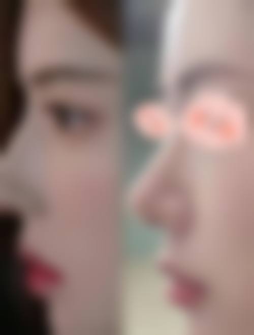 六、鞍山市第三医院整形美容外科怎么预约：