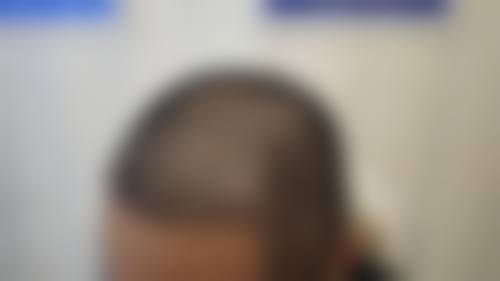 六、北京冯立哲医疗美容门诊部怎么预约：