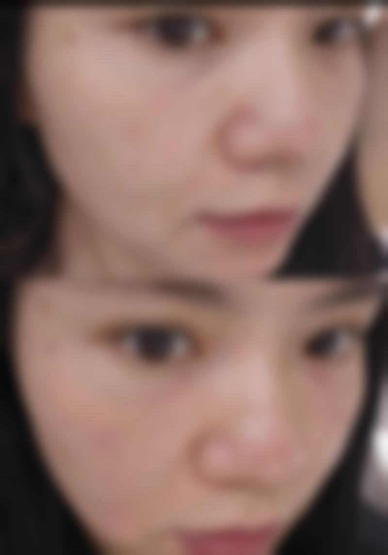 徐磊医生实例