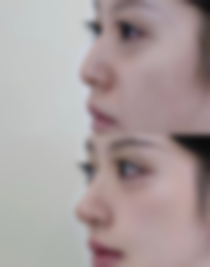 七、牡丹江邹忠明医疗美容诊所价格表：（仅供参考）