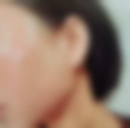 1880元get少女线,成效真的绝绝子