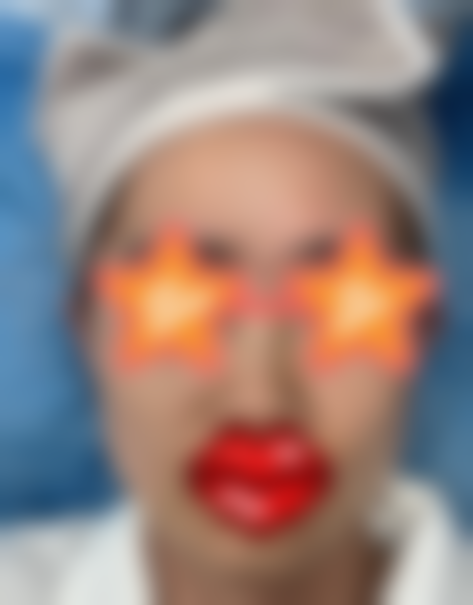 暗黄肌别慌！贵阳利美康宋医生光子水光体验980元焕亮光泽肌