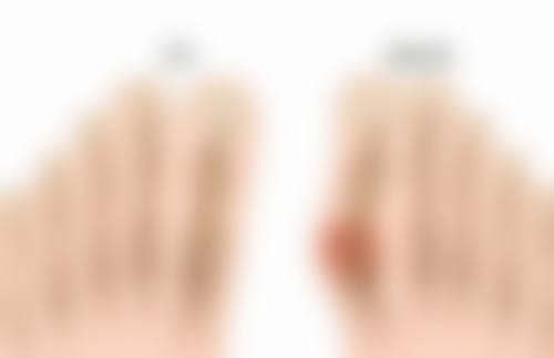 瘦脸针100u究竟是多少剂量？揭秘其精准配比与显著瘦脸效果的秘密 