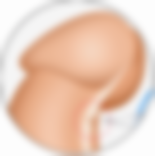 手术疤痕增生如何治疗？多种疗法结合成效好