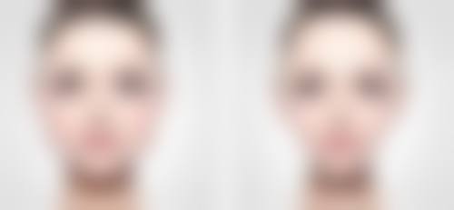 五、淮北濉溪县医院实例