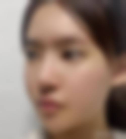 五、秦皇岛百惠医疗美容诊所实例