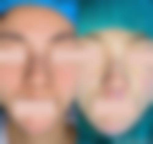 七、吉林赵艳君美容医院真实的顾客评价如下：