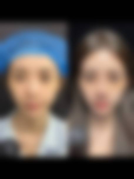 八、天津滨海新区怡贝德尚医疗美容门诊部真实的顾客评价如下：