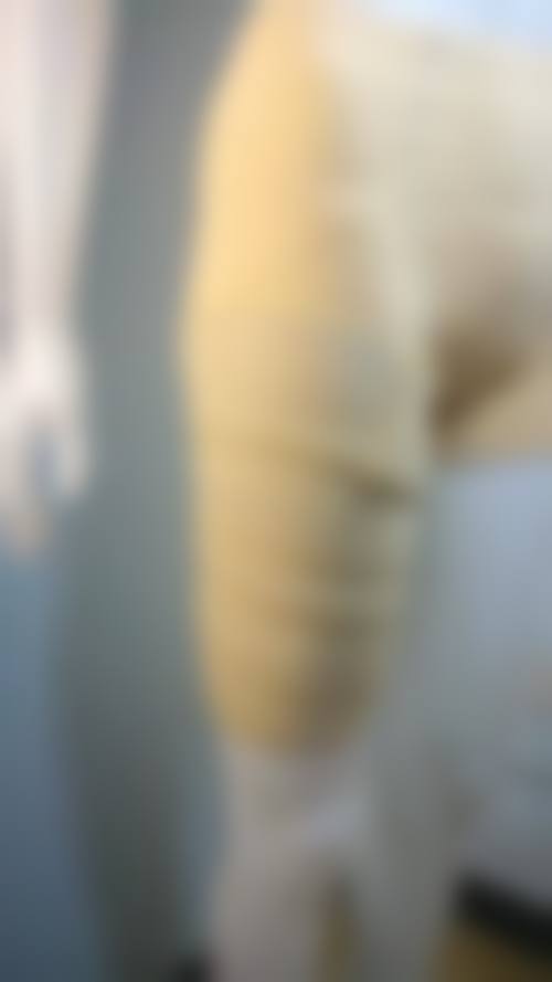 五、宜春丰城徐赵庆整形医疗美容诊所实例