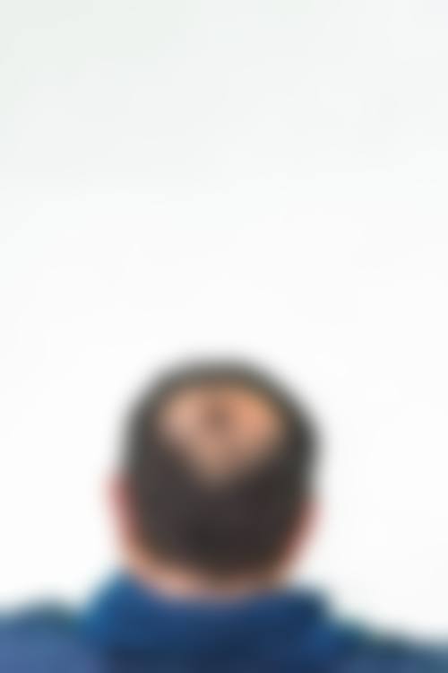 三、重庆厚森植发医生介绍: