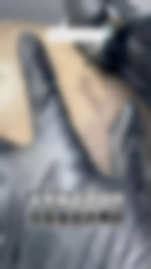 五、重庆厚森植发实例