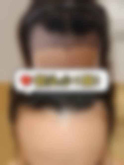 八、重庆厚森植发真实的顾客评价如下: