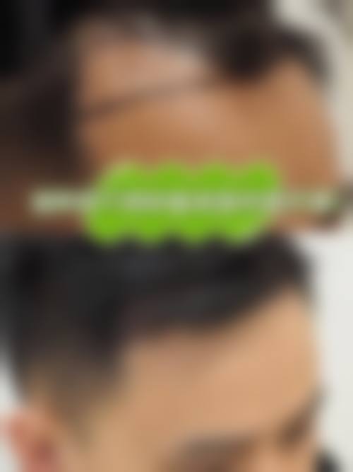 六、重庆厚森植发怎么预约: