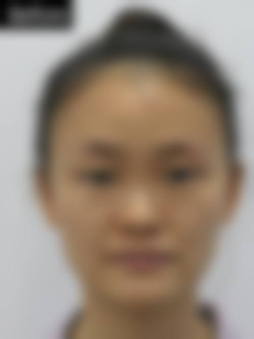 八、秦皇岛百惠医疗美容诊所真实的顾客评价如下：