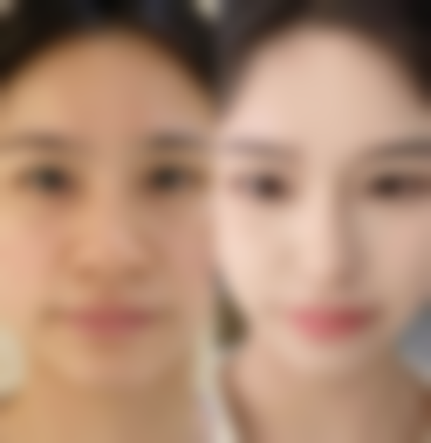 探究瘦脸针100u精细配比的奥秘