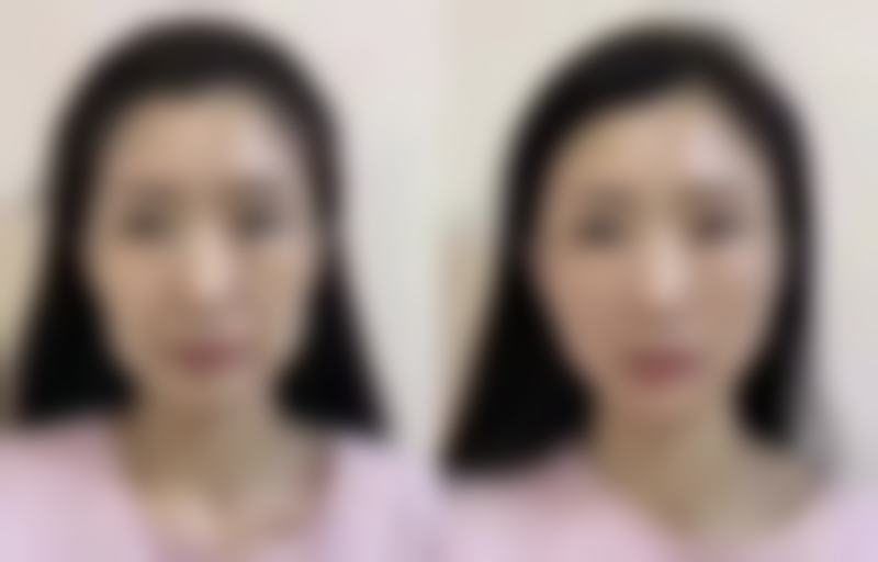 七、天津滨海新区怡贝德尚医疗美容门诊部价格表：（仅供参考）