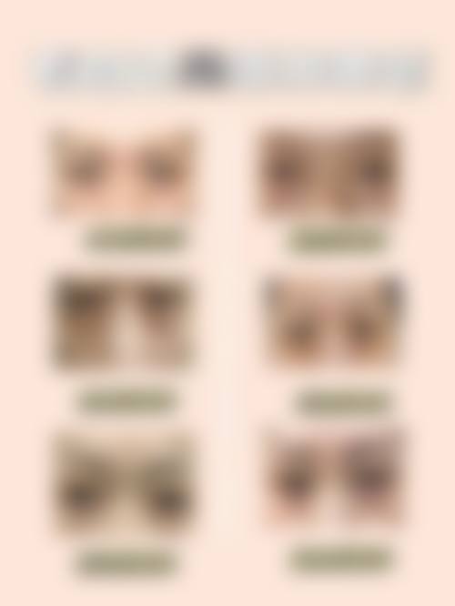 七、伊犁梵洛希整形医院真实的顾客评价如下: