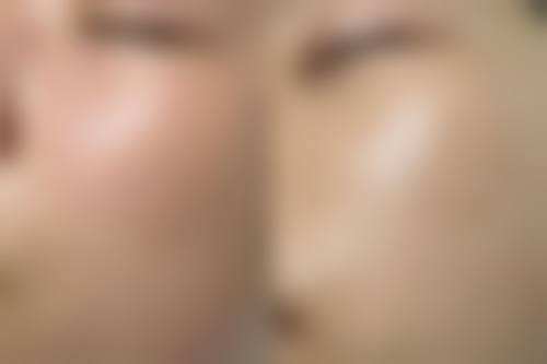 五、漳州华美紫馨整形医学美容门诊部怎么预约：